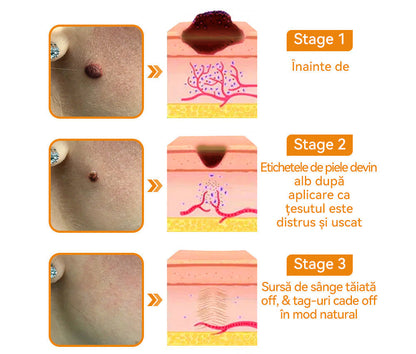 🌿LIPOGO™ 𝑩𝒆𝒆 𝑽𝒆𝒏𝒐𝒎 𝑾𝒂𝒓𝒕 𝐓𝐫𝐞𝐚𝐭𝐦𝐞𝐧𝐭 𝑪𝒓𝒆𝒂𝒎(🔥𝑳𝒂𝒔𝒕 𝒅𝒂𝒚 𝒑𝒓𝒐𝒎𝒐𝒕𝒊𝒐𝒏 80% 𝒐𝒇𝒇)