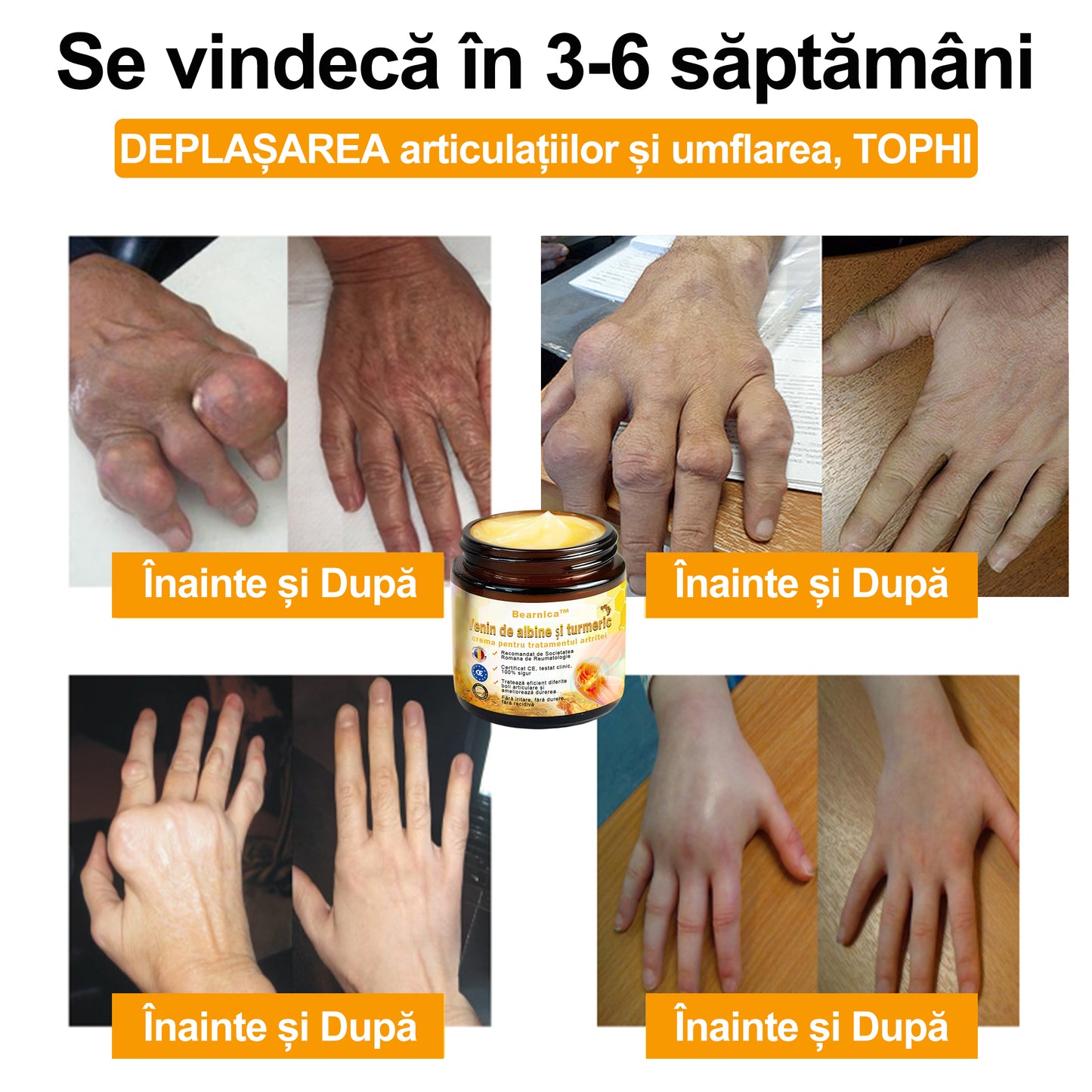 🎁 Mai sunt doar 5 cutii disponibile! Oferim încă 50% reducere!