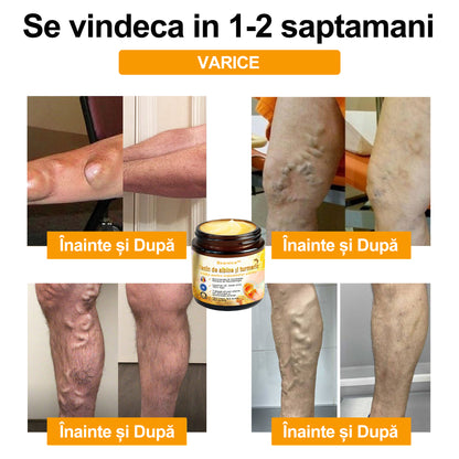 🎁 Mai sunt doar 5 cutii disponibile! Oferim încă 50% reducere!